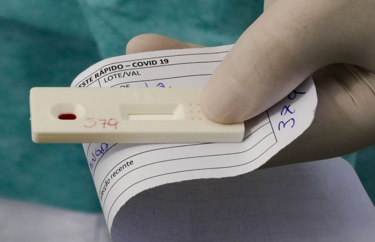 Covid-19: Brasil tem 5,35 milhões de casos e 156,4 mil mortes