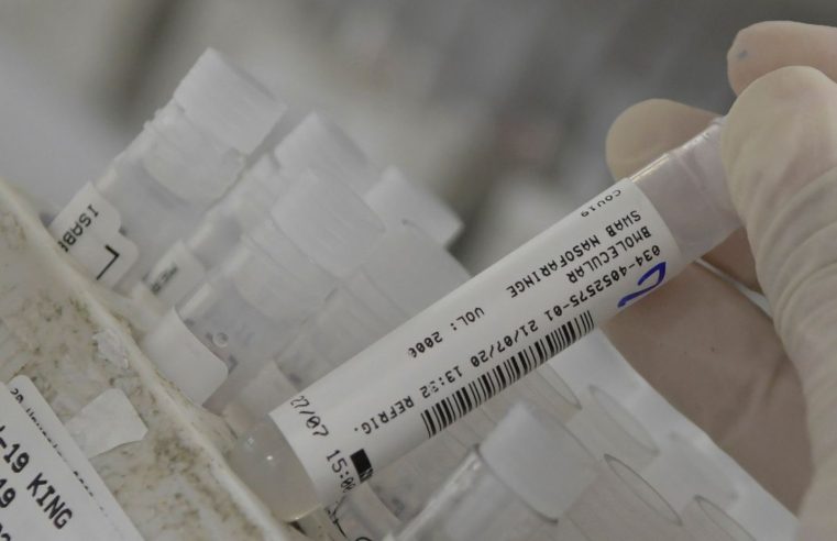 No Brasil, casos de covid-19 caem 19% e mortes diminuem 17%