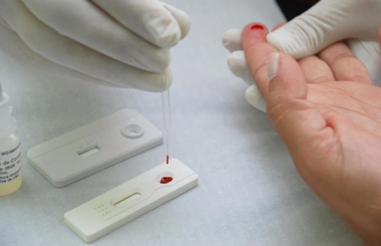 RN: Casos de sífilis estão subnotificados devido à baixa testagem no período da pandemia, aponta CONASS