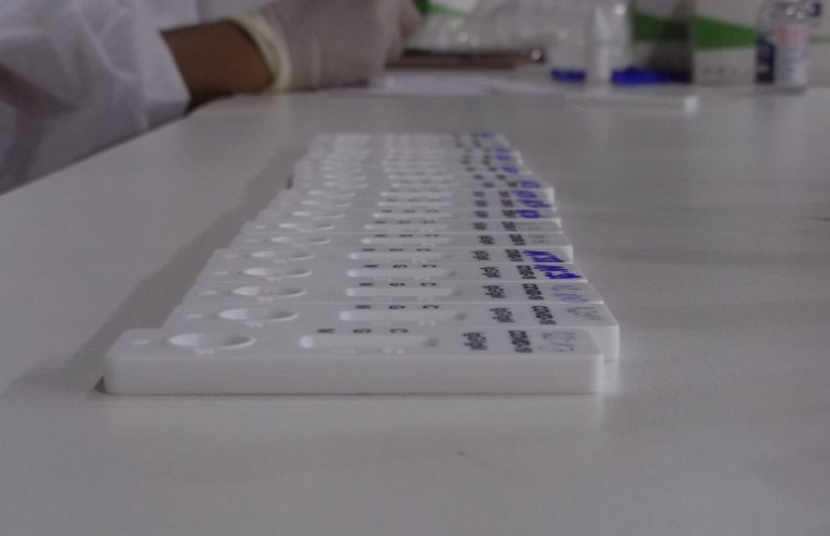 Bairro da Glória e Vale do Cuibá recebem ações de testagem em massa para a Covid-19 nesta quinta-feira (10)