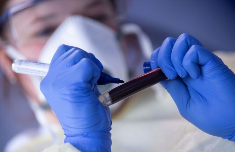 Covid-19: óbitos passam de 240 mil e casos somam quase 10 milhões