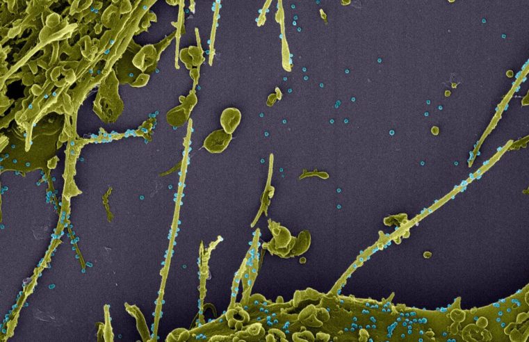 Covid-19: França investiga nova variante que escapa a teste PCR