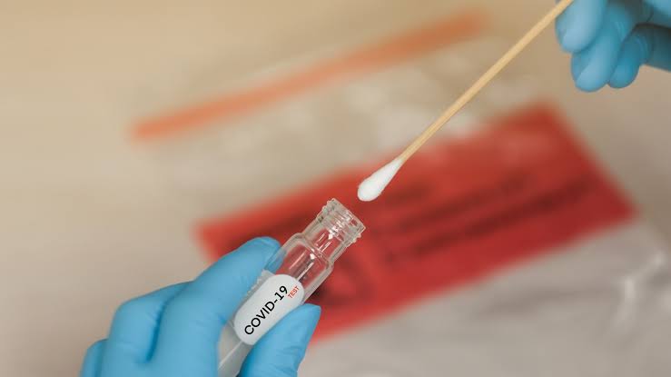 Resultados laboratoriais de exames para detecção da Covid colhidos em toda a rede pública e privada do Município deverão ser, obrigatoriamente, notificados à Secretaria Municipal de Saúde