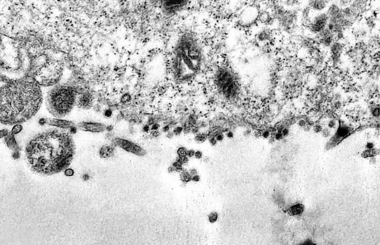 Covid-19: Rio tem dois novos casos de variante Delta