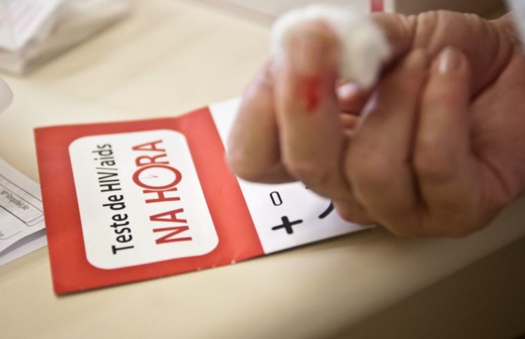 USP participará de rede global para encontrar a cura do HIV