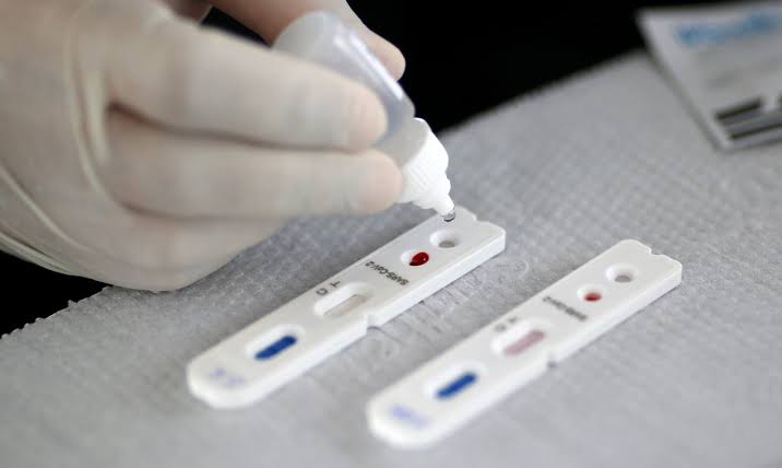 Testa Petrópolis: saúde inicia busca ativa para testar pacientes com sintomas de covid-19