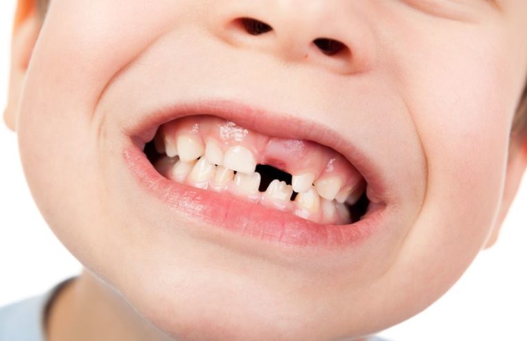 Programa Primeiro Sorriso e o cuidado com o dente de leite
