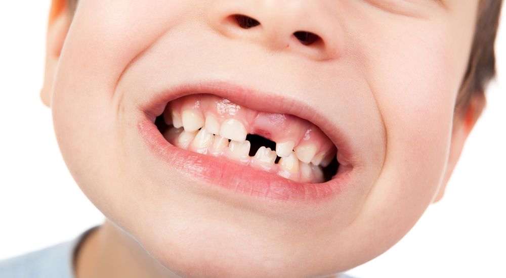 Programa Primeiro Sorriso e o cuidado com o dente de leite