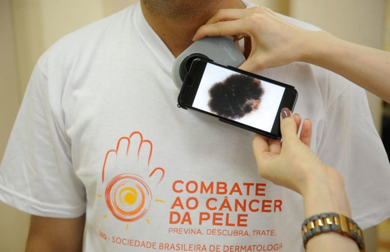 Guia procura esclarecer relação entre covid-19 e lesões de pele