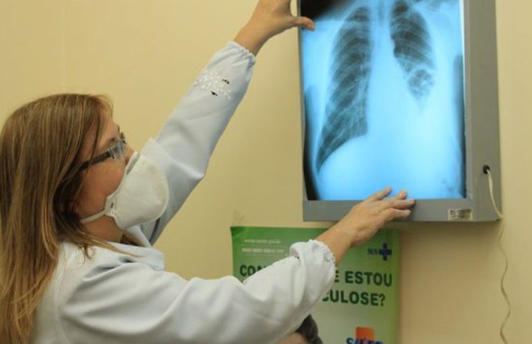 RJ, Acre e Amazonas lideram ranking de mortes por tuberculose no país