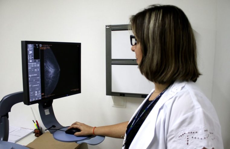 Centro de Saúde disponibiliza vagas para realizar exame de mamografia por livre demanda