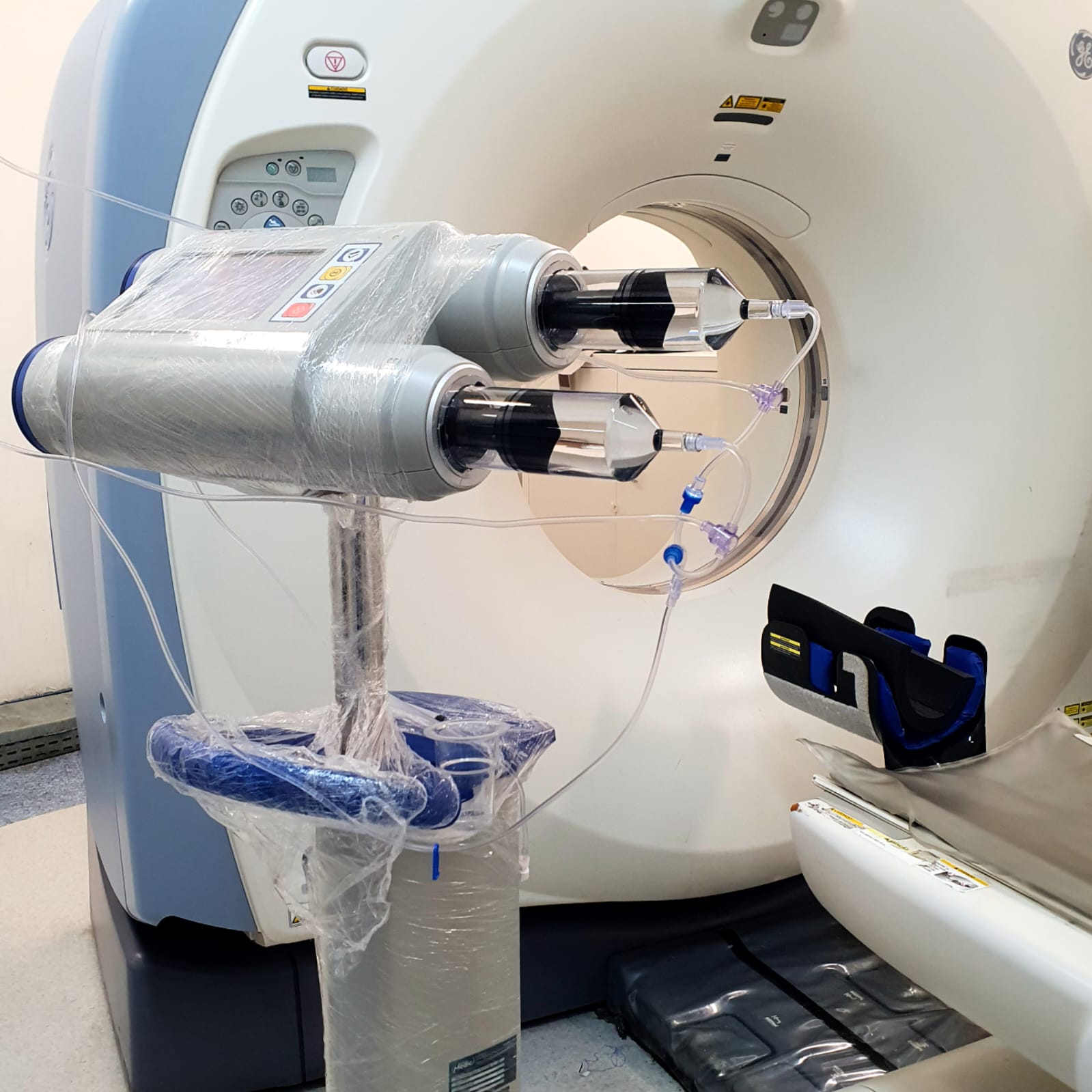 Hospital Alcides Carneiro volta a contar com bomba infusora de contraste após três anos