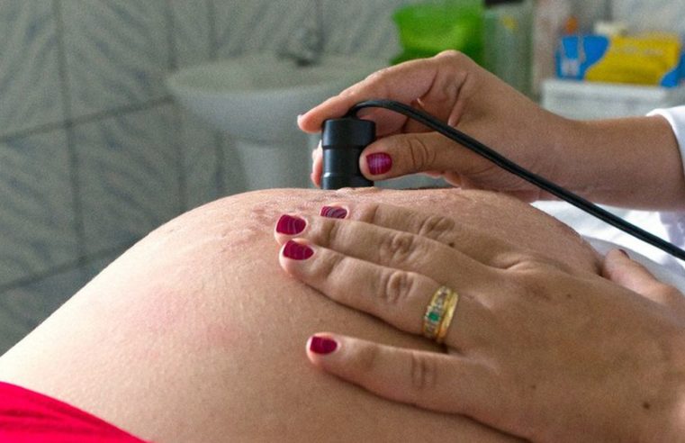 Entidade alerta para risco de diabetes em gestantes