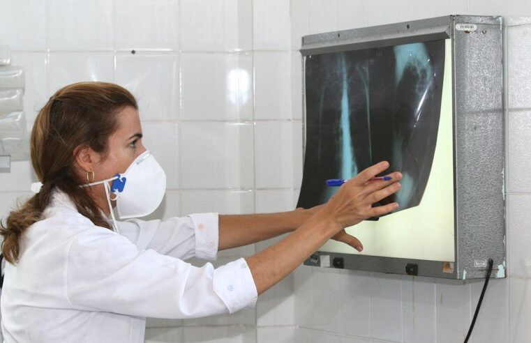 Brasil registra 78 mil novos casos de tuberculose