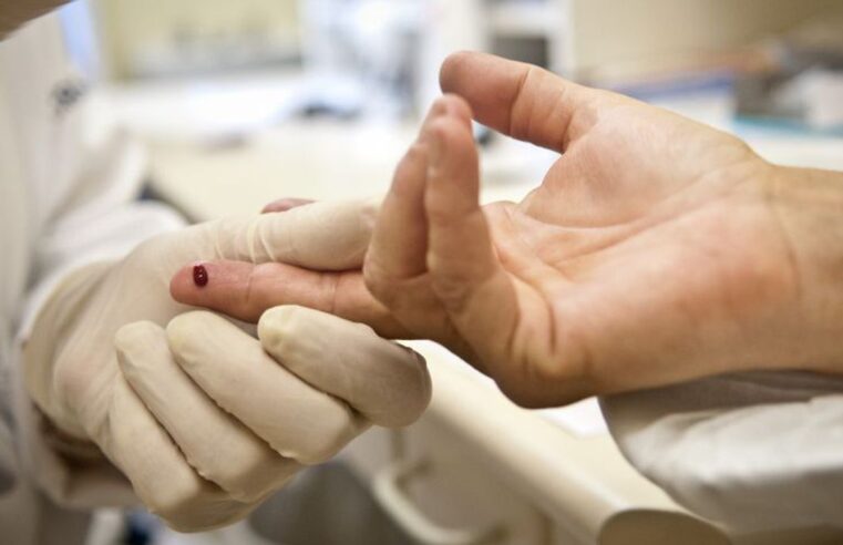 Justiça proíbe exigência de teste HIV para candidatos a concursos