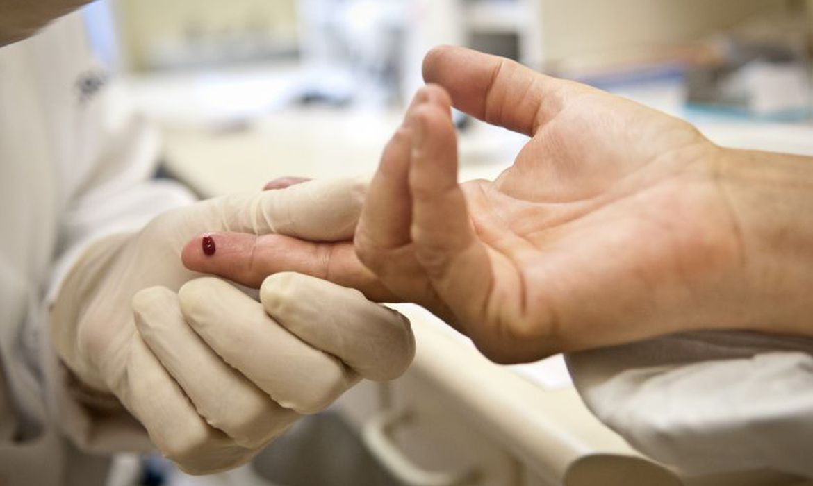 Justiça proíbe exigência de teste HIV para candidatos a concursos