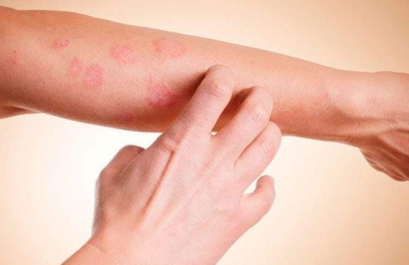 Dezembro Laranja: câncer de pele traz preocupação a mais para o verão dos brasileiros