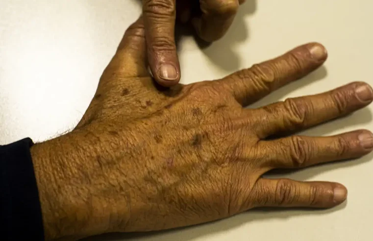 Inca manifesta apoio a imposto seletivo sobre bebidas alcoólicas