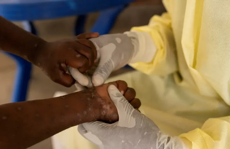 Mpox: OMS aprova primeira vacina para uso emergencial em crianças