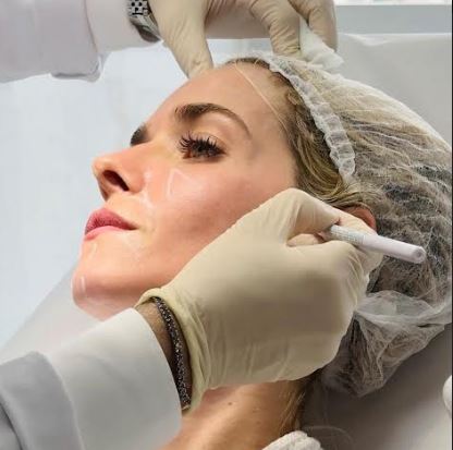 Busca pela beleza natural ganha espaço e pode colocar fim à harmonização facial