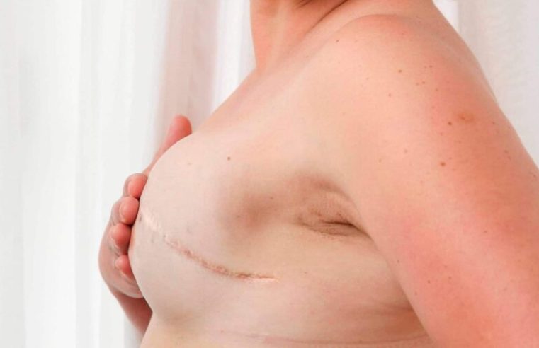 Reconstrução mamária: um caminho para a recuperação e a autoestima no Outubro Rosa