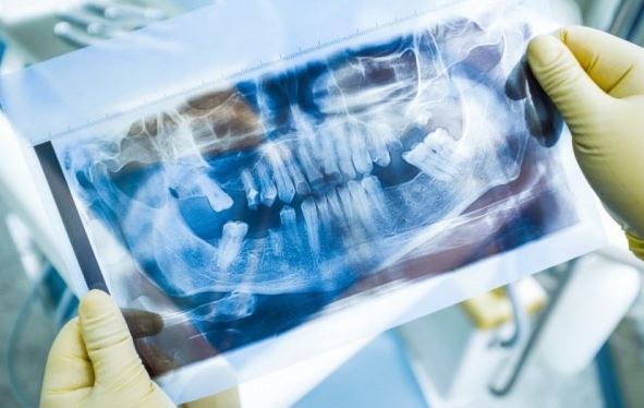 A saúde bucal e os riscos da estética facial